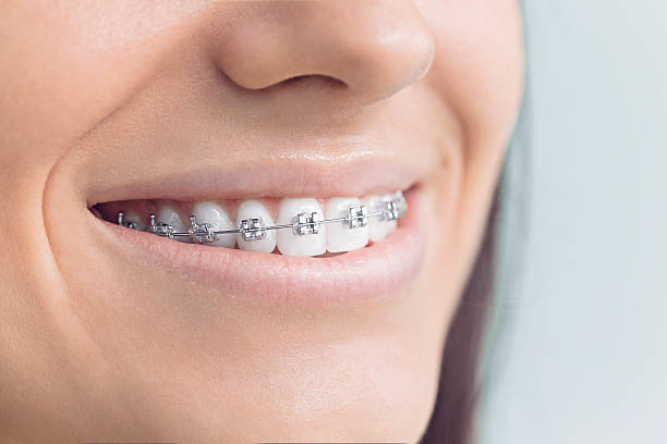 Best Veneers and Lumineers  in Pine Valley, CA